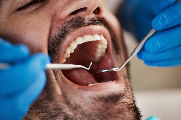 Best Cracked Tooth Emergency Dentist  in Warrington, FL